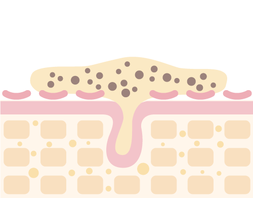 肌のイメージ
